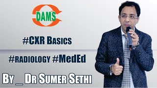 CXR Basics  By Dr Sumer Sethi radiology MedEd [upl. by Melnick]