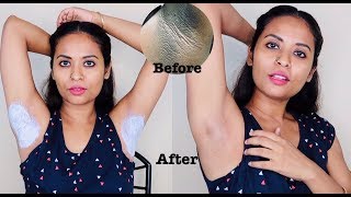 Live Result In Just 10 minutes Dark Underarm Whitening 100 Works [upl. by Giuditta]