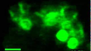 NIDCR Actin During Regulated Exocytosis in a Salivary Acinar Cell [upl. by Aikcin]