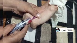 How to inject intravenous  IV  injection  TV Sohail [upl. by Ramalahs]