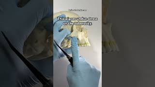 💀 How To Break The Tuberosity  OnlineExodontiacom  dentaltips dentist [upl. by Cartie]