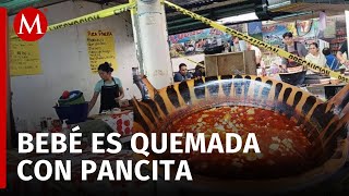 Bebé de 4 meses sufre quemaduras tras caerle una cazuela hirviendo en Amecameca [upl. by Sateia]