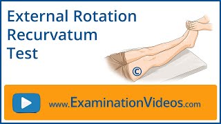 External Rotation Recurvatum Test [upl. by Eanore817]