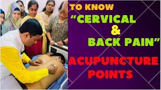 TO KNOW quotCERVICAL amp BACK PAINquot ACUPUNCTURE POINTS [upl. by Aleusnoc]