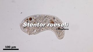 Stentor roeseli Ciliophora [upl. by Nimar]