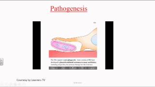 Haemophilus [upl. by Newol]