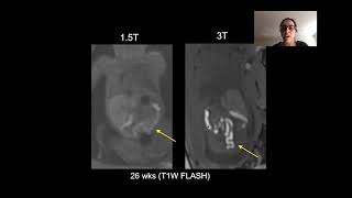 Topics in Fetal Medicine MR Fetal Imaging [upl. by Spaulding]