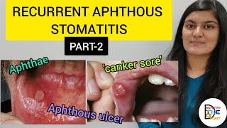 RECURRENT APHTHOUS STOMATITIS RAS PART 2 [upl. by Shayn]