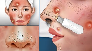 ASMR Causes and The best treatment for the girl who bought a fake face spa with a red face allergy [upl. by Setiram914]