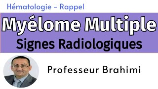 Myélome Multiple Signes Radiologiques [upl. by Chellman462]