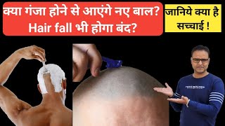 क्या गंजा होने से आएंगे नए बाल Hair fall भी होगा बंद जानिये क्या है सच्चाई [upl. by Seve]