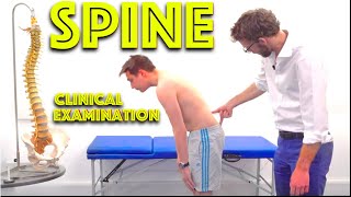 Spine Examination  Back Pain Assessment  4K  Clinical Skills  Dr Gill [upl. by Lerrad]