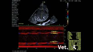 Dilated Cardiomyopathy DCM [upl. by Jo-Ann]