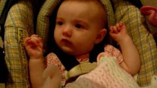 Infantile spasms infant seizures [upl. by Tsnre]