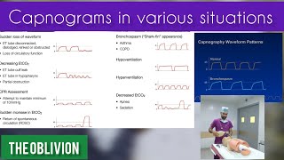 End tidal Carbon DioxideCO2 Monitoring Capnograms in various situationsmedicalEtCO2anaesthetic [upl. by Eyk]