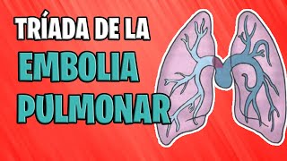 ✅ EMBOLIA PULMONAR EN INSUFICIENCIA CARDÍACA  TRÍADA DE ALLEN FÁCIL shorts [upl. by Llejk]