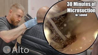 30 Minutes of MICROSUCTION Ear Wax Removal [upl. by Suivatram]