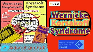 Wernickes Korsakoff Syndrome [upl. by Pravit]