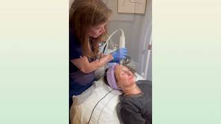 Skin Rejuvenation  Microneedling [upl. by Gypsie4]