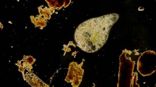 🔬 living under a dark field microscope 5  smooth microorganisms in the puddle ralaxing sound [upl. by Asyar]