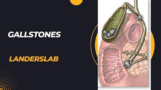 Cholelithiasis cholecystitis choledocholithiasis cholangitis pancreatitis [upl. by Atinuaj767]