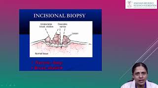 Dr Ambika Department of Oral Pathology Biopsy and Exfoliative Cytology [upl. by Nevyar]