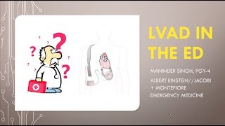 LVAD in the ED [upl. by Eerual113]