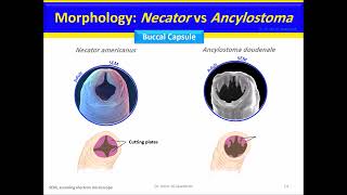 Nematodes Hookworm Ancylostoma duodenale Necator americanus [upl. by Anjanette]