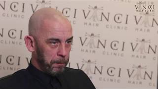 Vinci Hair Clinic Manchester MSP testimonial [upl. by Leid337]