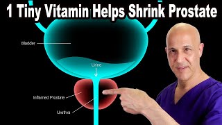 1 Tiny Vitamin Helps Shrink Your Enlarged Prostate  Dr Mandell [upl. by Icak]