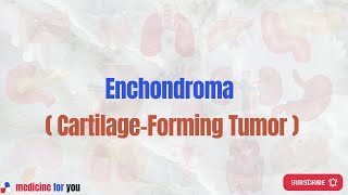 Enchondroma  CartilageForming Tumor [upl. by Svoboda457]