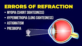 Errors of Refraction  Myopia  Hypermetropia  Astigmatism  Presbiopia  Short amp Long Sightedness [upl. by Enajyram]