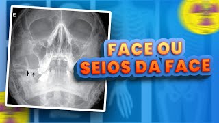 RAIO X DE FACE E SEIOS DA FACE APRENDA SUA DIFERENÇA  Radiologando [upl. by Granlund]