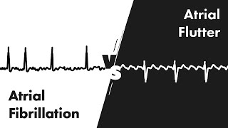 Atrial Fibrillation vs Atrial Flutter  ECG EKG Interpretation  MEDZCOOL [upl. by Sineray]