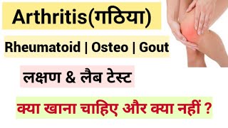 Arthritis in Hindi  Rheumatoid arthritis in hindi  Arthritis Symptoms  Arthritis Treatment [upl. by Covell]