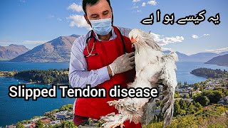 Treatment and cause of Slipped tendon in Brahma Chicken Perosis in chicken [upl. by Michaele161]