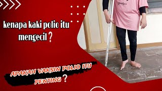 KENAPA KAKI POLIO ITU MENGECIL DAN APAKAH VAKSIN POLIO ITU PENTINGDIFABEL POLIO [upl. by Sinaj]