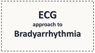 ECG Approach to Bradyarrhythmia  Bradycardia  Simplified [upl. by Chen]