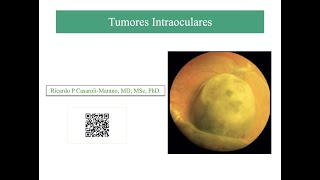 Clase de Tumores Intraoculares [upl. by Ayarahs]