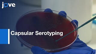 Capsular Serotyping Streptococcus pneumoniae Using Quellung Reaction [upl. by Schoenburg]