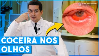 Derrame nos olhos O que fazer [upl. by Adianes65]