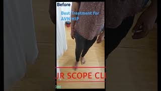 Best Non Surgical Treatment for Avasular Necrosis of Hip lifescopeclinic hippaintreatment [upl. by Hayouqes]