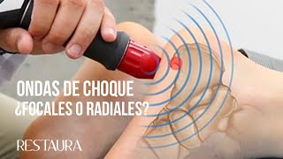 Cuáles son las mejores ondas de choque ¿Focales o radiales [upl. by Matthia849]