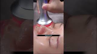 ASMR Facial massage and skin rejuvenation laser treatment for women skincare relax [upl. by Johnson]