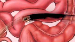 Purdue University Research in Medicine Smart Capsule for Intestines [upl. by Lunt]