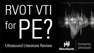 RVOT VTI for PE [upl. by Dann61]