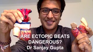 Are ectopic heart beats dangerous [upl. by Levitus]