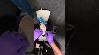 Peripheral IV insertion and removal of peripheral IV [upl. by Harrod455]