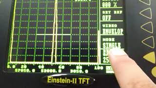 Difference Between Einstein II TFT amp Einstein II DGS [upl. by Darryl]