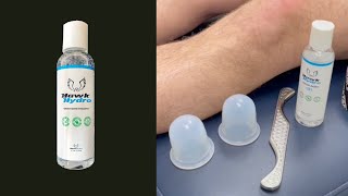 Runners Knee Pain Relief IASTM Cupping amp Taping with HawkHydro [upl. by Pitt]